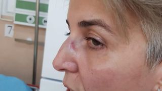 Scandal într-un spital din Giurgiu! O asistentă a fost bătută crunt de o colegă