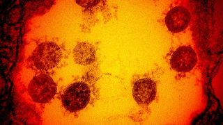 "Am ajuns să mâncăm șobolani". Țara îngenuncheată de al doilea lockdown