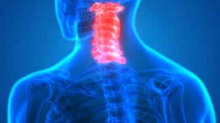 coloana cervicala hernie probleme sanatate