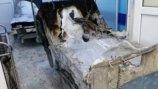 femeie arsă piatra neamț