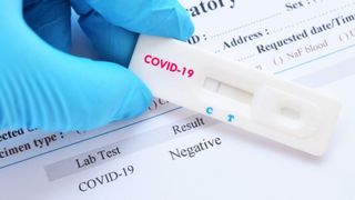 Persoanele vindecate de COVID-19 pot avea până la şase luni imunitate după infecţie