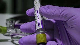 merkel germania prelungeste restrictiile