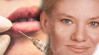 VIDEO - Chinul prin care au trecut victimele falsului medic estetician