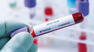 Un cunoscut politician, infectat cu coronavirus