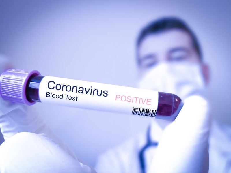 Noua tulpină de coronavirus