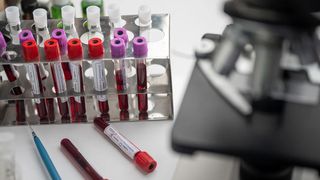 Actorul român care șochează ţara: „Virusul a fost creat în laborator. Femeile se vor steriliza!”