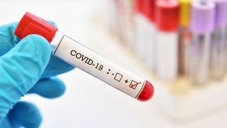 Coronavirus în România, bilanț 5 ianuarie: 4.729 de noi cazuri de COVID-19