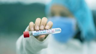 Situație critică în Spania din cauza CORONAVIRUS. Număr mare de infectări