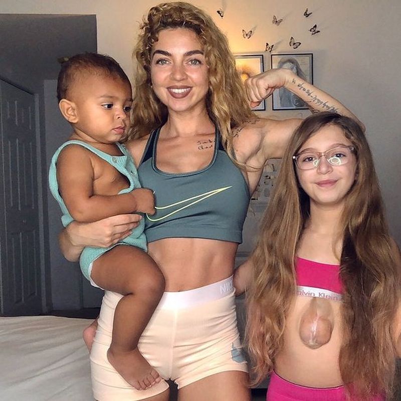 copila născută cu inima în afara pieptului