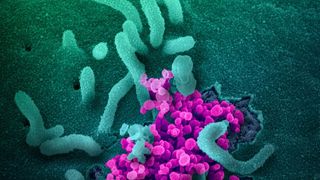 "Noua tulpină de coronavirus, mai mortală decât cele vechi". O somitate medicală a făcut avertismentul teribil