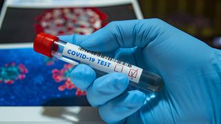 noua tulpină de covid 19 din marea britanie