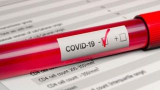 Bilanț Coronavirus, marți 16 februarie 2021. Câte noi cazuri s-au raportat în ultimele 24 de ore?