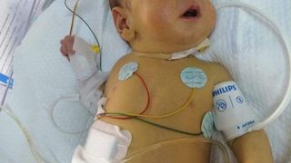 Strigăt de ajutor pentru Matei. Povestea emoționantă a unui bebeluș de cinci luni