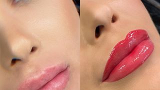 VIDEO - Proceduri speciale pentru buze în saloanele de înfrumusețare