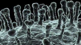 femeie moartă norvegia după ce s-a vaccinat