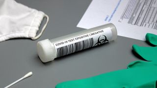 coronavirus în franța