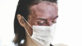 Ministerul Sănătății: „Anticorpii anti-COVID-19 sunt prezenţi în organism la 6 şi chiar 8 luni de la infectare”