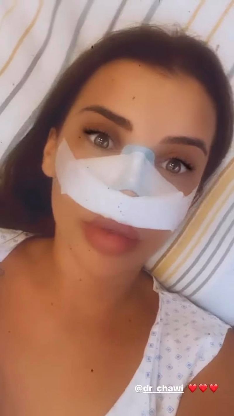 andra volos de la puterea dragostei operație la nas