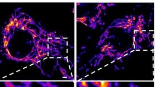 Descoperire incredibilă despre COVID-19. Ar putea fi o afecțiune vasculară, nu respiratorie!