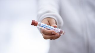 Bilanț coronavirus România 9 mai 2021: 857 cazuri noi de persoane infectate