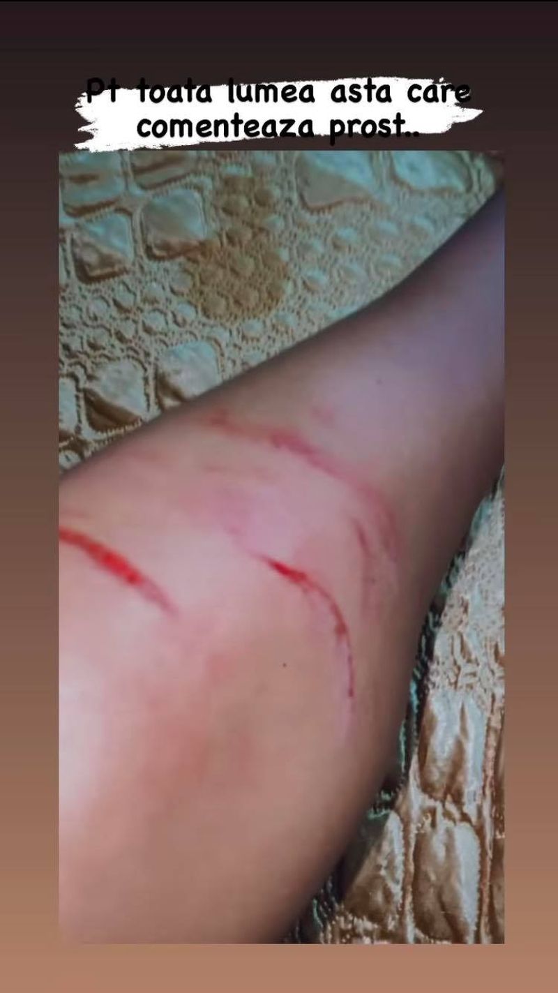 accident-rutier-ella-de-la-puterea-dragostei