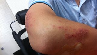 accident rutier la cluj