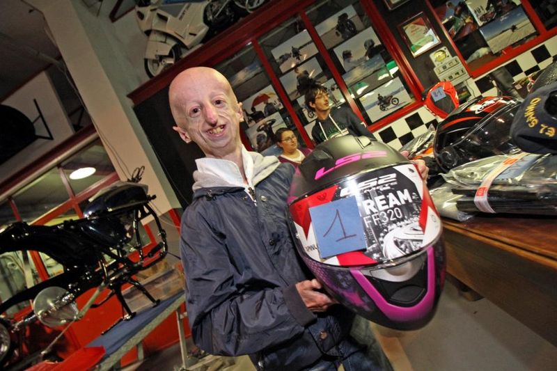 povestea copilui de șase ani care îmbătrânește rapid