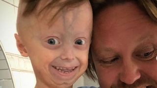 VIDEO| Povestea tragică a copilului de șase ani care arată ca un bărbat de 60. Care este cauza îmbătrânirii