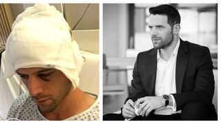 Un actor celebru din România a fost diagnosticat cu două tumori la cap: „Să cad pe stradă, nu-mi venea să cred”