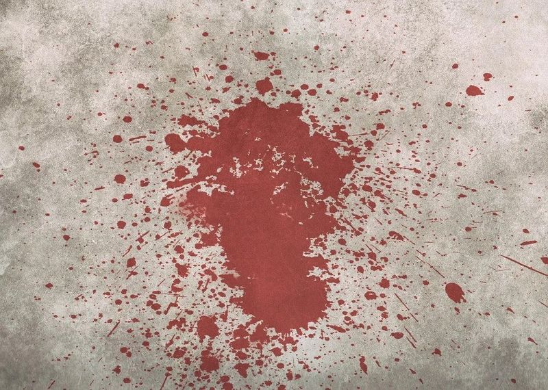 Interpretare vise: Ce înseamnă când visezi sânge?