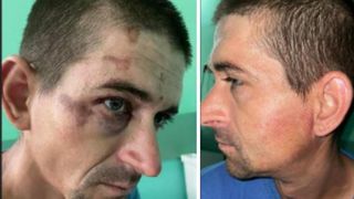 Un român a ajuns în stare gravă la spital după ce a fost bătut de mai mulți jandarmi. Avea urme de bocanc pe corp