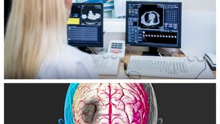 Descoperire șocantă despre pacienții aflați &icirc;n stare vegetativă