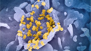 OMS, anunț de ultim moment despre virusul mutant Lambda, apărut în Peru