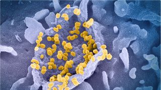 Virusul mutant Delta face tot mai multe victime în România