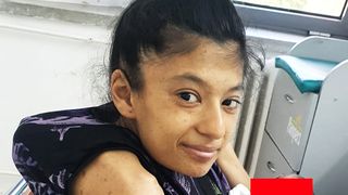 VIDEO | Miracol medical: o femeie care c&acirc;ntărește doar 27 de kilograme a devenit mamă! A născut o fetiță de aproximativ 2 kilograme