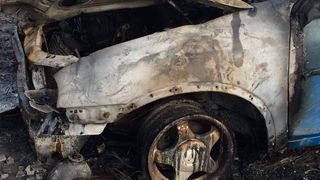 Un bărbat are arsuri pe 30% din suprafaţa corpului. El și-a dat foc mașinii din greșeală