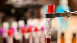 Tratament anti-Covid cu ceai și pălincă