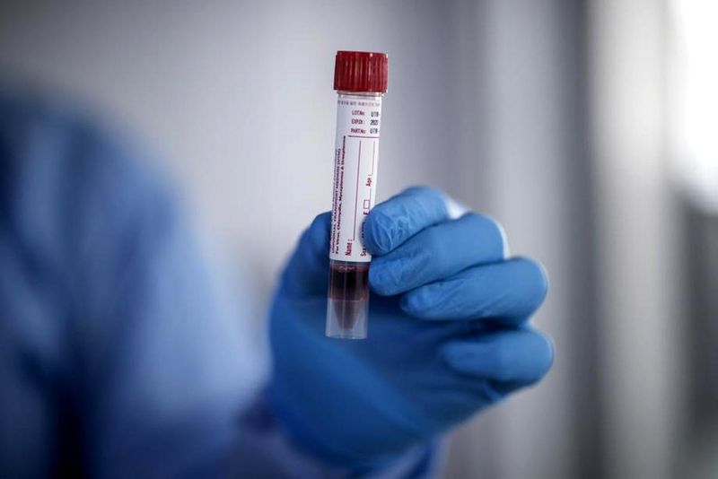 Bilanţ COVID azi, 2 septembrie 2021