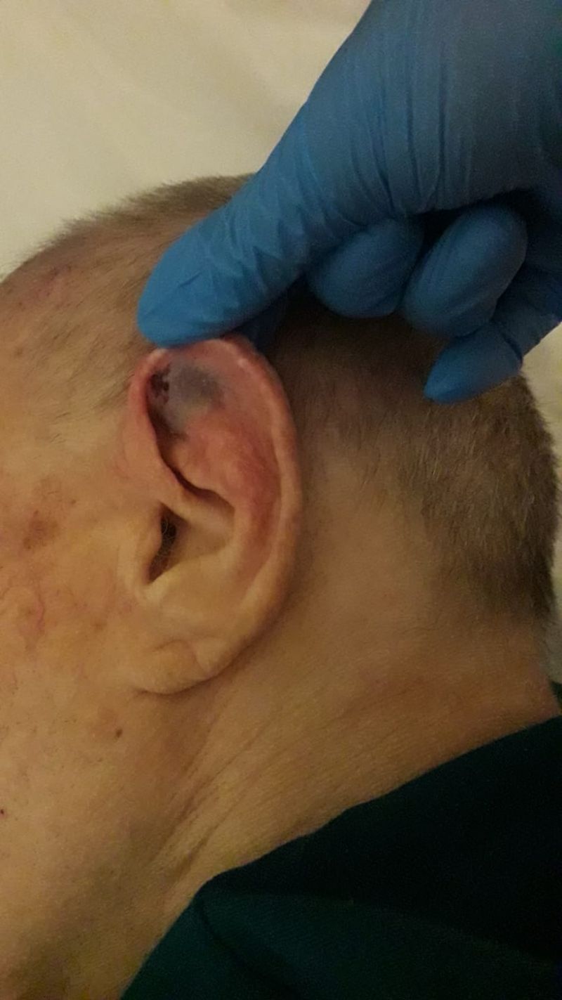 Bărbat maltratat la un azil de bătrâni din Câmpina. Acuzații grave făcute de fiica victimei: „Tata mi-a spus că acolo era pușcărie”