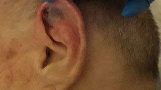 Bărbat maltratat la un azil de bătrâni din Câmpina. Acuzații grave făcute de fiica victimei: „Tata mi-a spus că acolo era pușcărie”