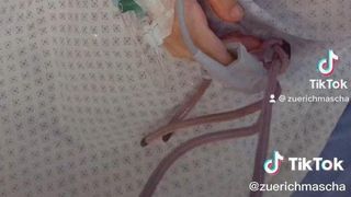 O adolescentă din Elveția a ajuns la spital după ce a băut 12 doze de energizant &icirc;ntr-o zi, la școală