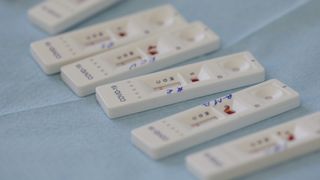 Aproximativ 200.000 de teste rapide au fost retrase de pe piață pentru rezultate fals pozitive