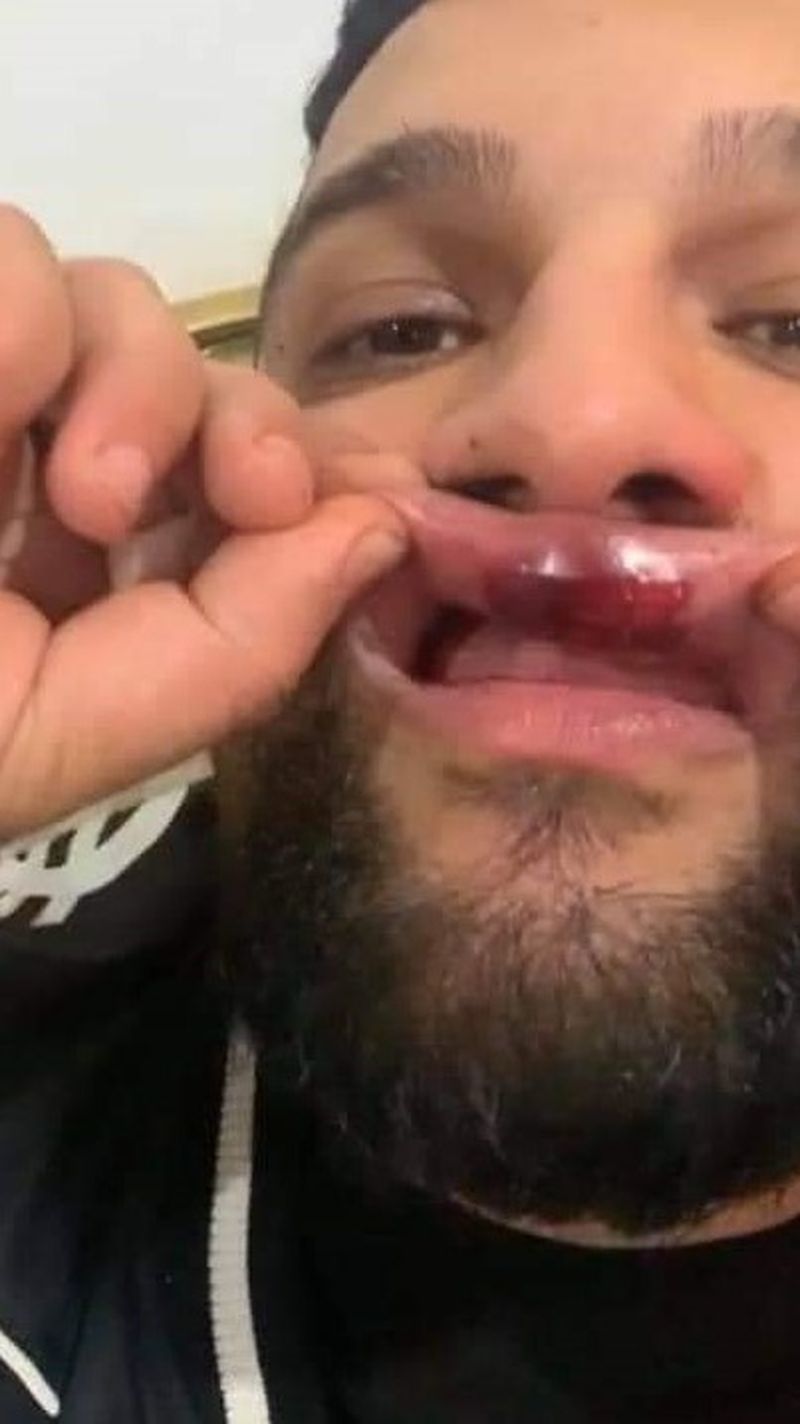 tzancă uraganu bătaie marymar mădălina miu