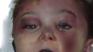 Criminaliștii au &icirc;ntocmit portretul robot al fetiței incendiate din Arad. Noi detalii șocante descoperite de anchetatori