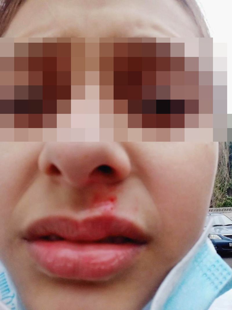 Un scandal cu accente de ură cutremură seminarul teologic din Galați, după ce o fetiță ar fi fost împinsă pe scări de colegi care au mai amenințat-o în trecut cu un cuțit 