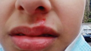 Un scandal cu accente de ură cutremură seminarul teologic din Galați, după ce o fetiță ar fi fost împinsă pe scări de colegi care au mai amenințat-o în trecut cu un cuțit 