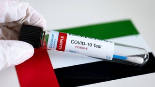 Premieră în lume. 100% din populaţia Emiratelor Arabe Unite eligibilă a primit cel puţin o doză de vaccin