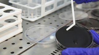 O bacterie periculoasă a fost identificată într-o soluţie oftalmică folosită la operaţii, la SJU
