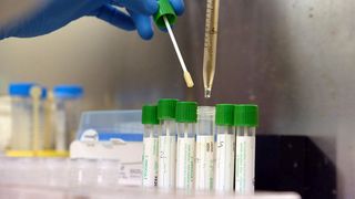 Aproape jumătate dintre persoanele testate gratuit la Spitalul „Victor Babeș” din Craiova au fost descoperite cu SARS-CoV-2