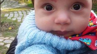 Bebelușul iubirii s-a născut cu o inimioară pe frunte. Băiatul a împlinit acum șase ani